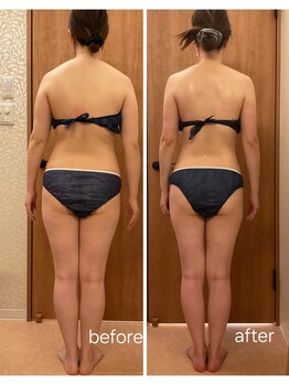 ルーメ(LUME)/パワーレメディ痩身90分