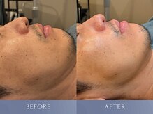 カズキ ハギワラ(Kazuki Hagiwara)/クリスティーナ当日ビフォアフ