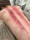 エービューティーサロン 松山店(A BEAUTY SALON.)の写真/【慢性疲労・コリ】１度で楽に動ける体へ！ラジオ波吸引マシンで全身のコリ・むくみをくまなく流します。