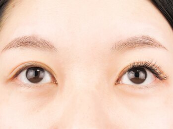 ルプラス(LUPLUS)/◆Before/After◆