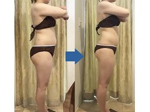 ピュアトゥルー 岐阜西店(PureTrue)/余分なお肉に高周波！ラジオ派！