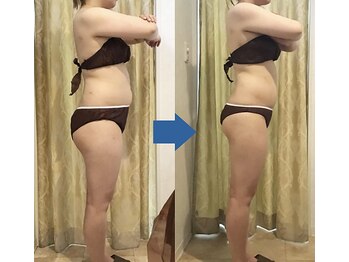 ピュアトゥルー 岐阜西店(PureTrue)/余分なお肉に高周波！ラジオ派！