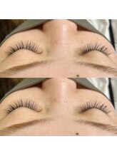 レジアント(Rediant)/フラットラッシュ140本