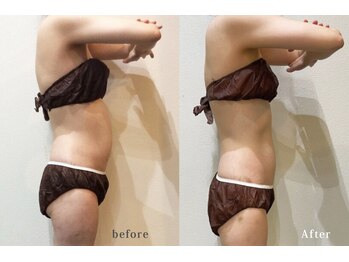 アネル 浦添店(anel)/実際のアネル会員様の結果です