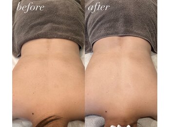 ハル(haru)/ビフォーアフター