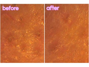 ポアレスラボ 東武百貨店池袋店/毛穴洗浄