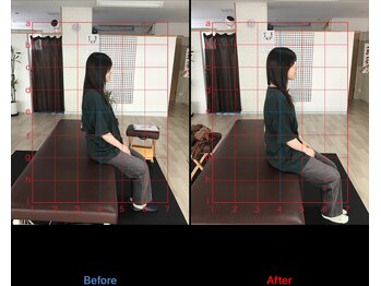 ストレチックス 近江八幡店/姿勢改善ビフォーアフター1回