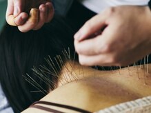 鍼処シラカワ なごや院千種(鍼処SHIRAKAWA)/