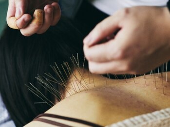 鍼処シラカワ なごや院千種(鍼処SHIRAKAWA)/