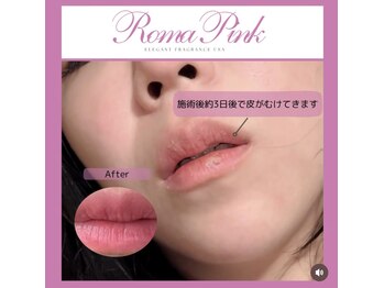 ルアナ 柏本店(LUANA)/ローマピンク