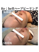 サラ/ハーブピーリング