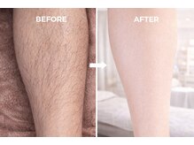 ヨハク(YOHAKU)/20代前半 &nbsp;男性 &nbsp;7回施術