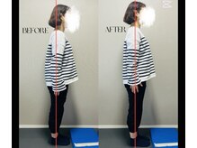 春日整体院ito/【姿勢改善ビフォーアフター】