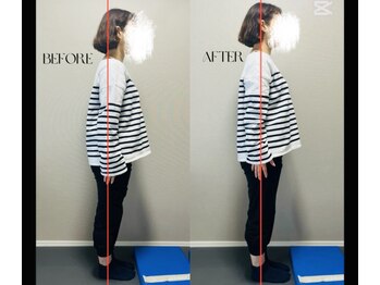 春日整体院ito/【姿勢改善ビフォーアフター】