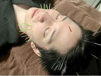 ヘッドサイエンス(HEADSCIENCE)の写真/メンズにも人気★美容鍼×育毛促進鍼で清潔感と第一印象を高める完全個室の実力派サロン！