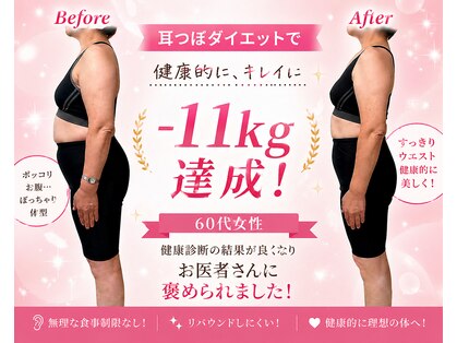 ア クイーユの写真