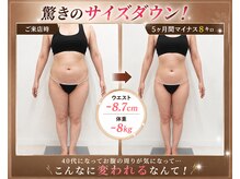 ラヴィアンローズ 岐阜本店(La vie en Rose)の雰囲気（スペシャル集中施術6ヶ月《お腹・二の腕・足・背中》）