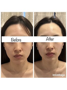 ビューティーサロン リリー(Lily)/