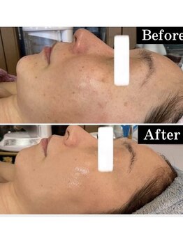 アンジェロ(Angelo)/グリンピールの威力