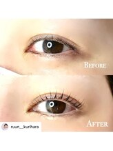 ルーン 千川要町(ruun)/こんなにも変化が！