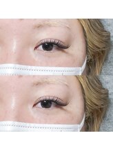 ゼロナナ 神戸三宮店(07)/バインドロック by sara