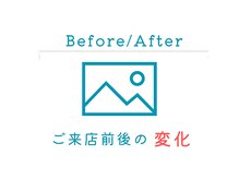 ネージュ(neige)/【施術前後の写真比較】劇的変化