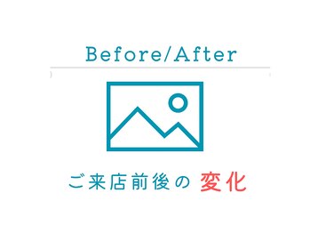 ネージュ(neige)/【施術前後の写真比較】劇的変化