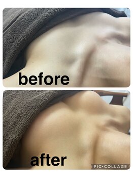 ギンザアール(GINZA R.)/バストケア♪