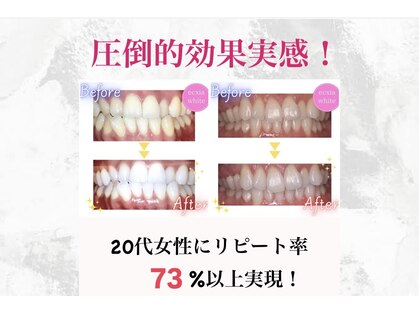 エクシアホワイトニング 姫路店の写真