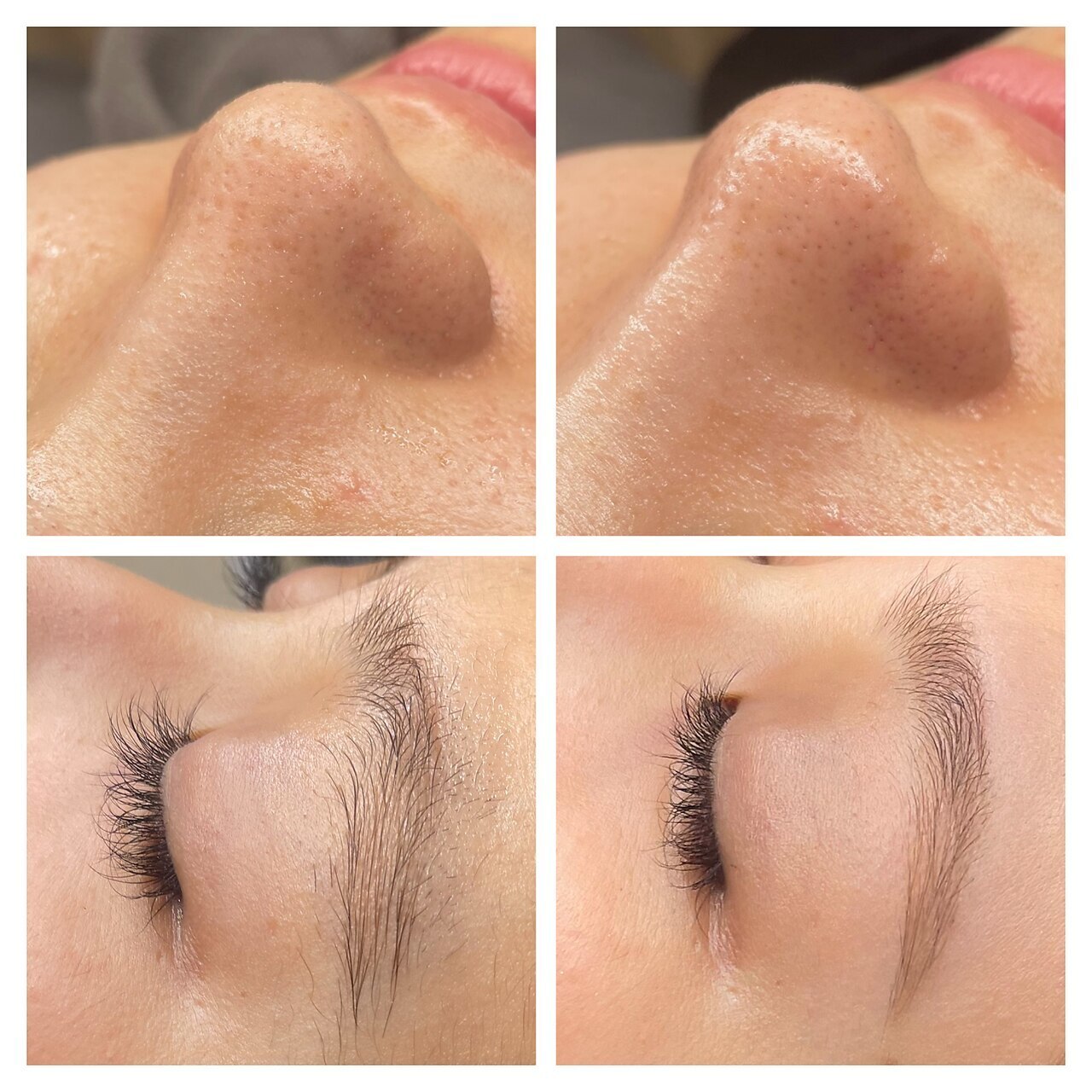 【お肌×眉毛のW美ケア】毛穴洗浄＆アイブロウwax＆パックケア \15400→\7700