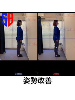 ストレッチブル 根津店(Stretchble)/姿勢のビフォーアフター