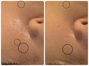 エフェクト 塚口店(effect)/Before After