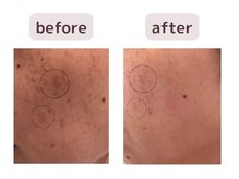 リジェネラティブセル メディカルサロン(Regenerative Cell Medical Salon)/ビフォーアフター