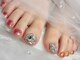 ミアネイル(Mia nail)の写真/秋冬にフットネイルお休みされる方に☆平尾で希少な韓国で話題の巻き爪ケアHeySwitch導入♪