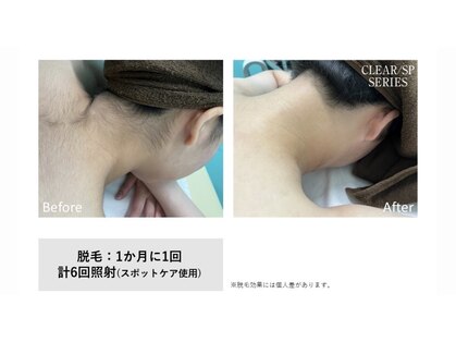 ハクビューティー 那須塩原 黒磯(HAKu beauty)の写真
