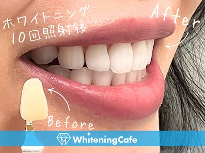 歯のホワイトニング 岐阜アクティブG店の写真