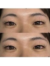 バニーアイズ 天神(Bunny eyes TENJIN)/フラット140本