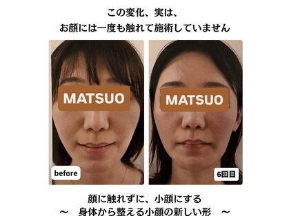 マツオ(MATSUO)の写真