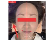 ボディトーン(bodytone)の雰囲気（美容整体ラボbodytone）