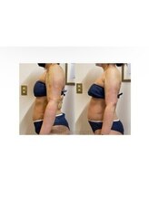 インディバケアプラチナム 横浜店/インディバ施術