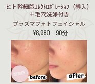エステティックサロン さら