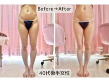 ピーチ(Peach)/骨盤矯正×痩身×リンパ エステ