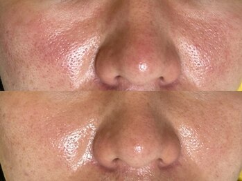 クラウン 心斎橋店(CROWN)/