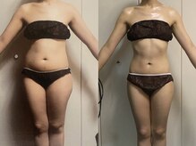 ロズアスールの雰囲気（ボディ痩身/痩身ダイエット/痩身リンパマッサージ/天王寺痩身）