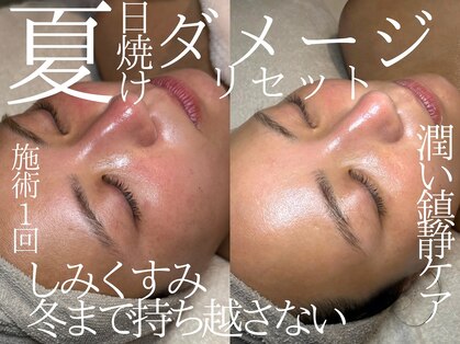 ルーツリー(Rootree)の写真
