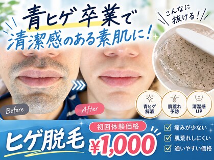 美痩身の写真