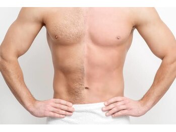 メンズラボ(Men's Lab)/脱毛は秋から冬がオススメ!