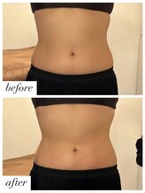 クオコア(KUOKOA)/気になるお腹回りに是非！