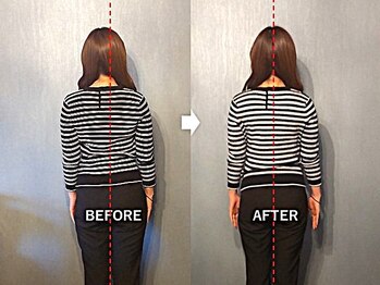 アトラス/初回のお客様のBefore＆after