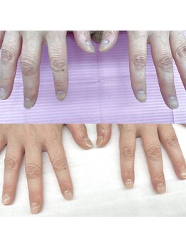 ハッカネイル(HAKKA NAIL)/